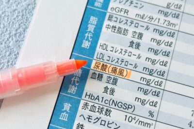 高尿酸血症とは